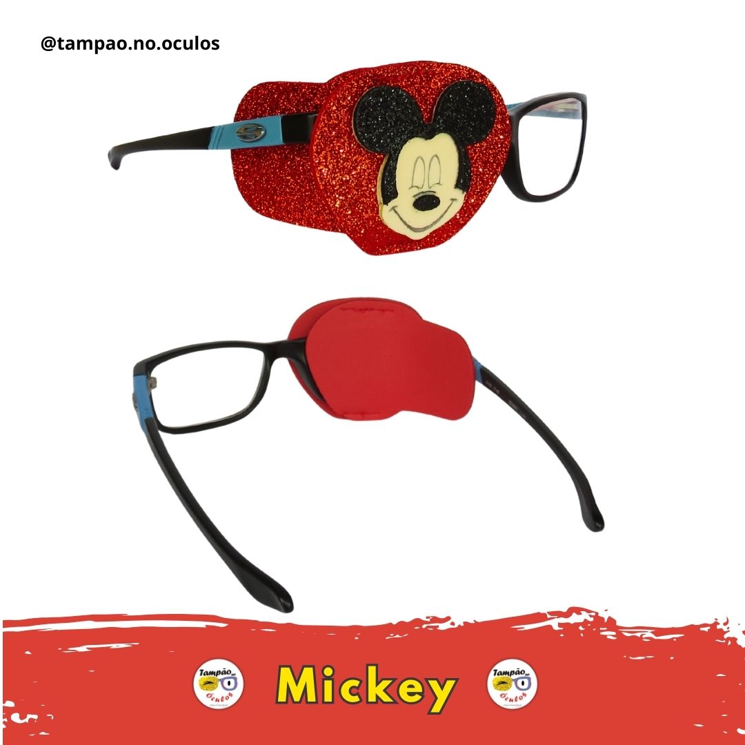 Mickey - Imagem 5