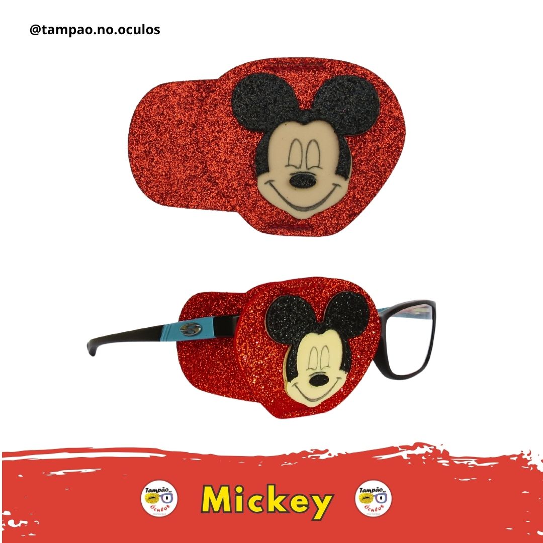 Mickey - Imagem 3