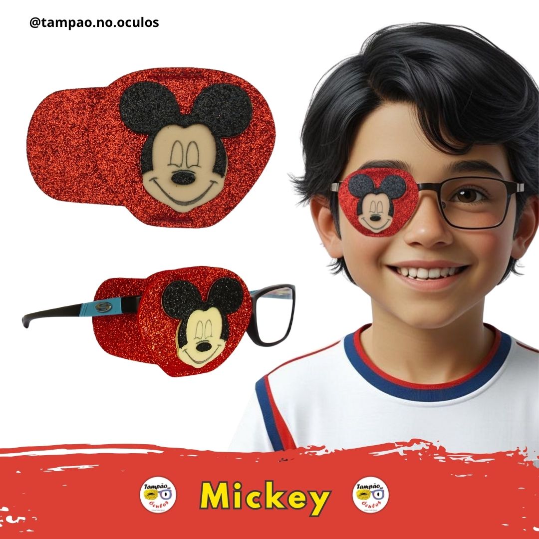 Mickey